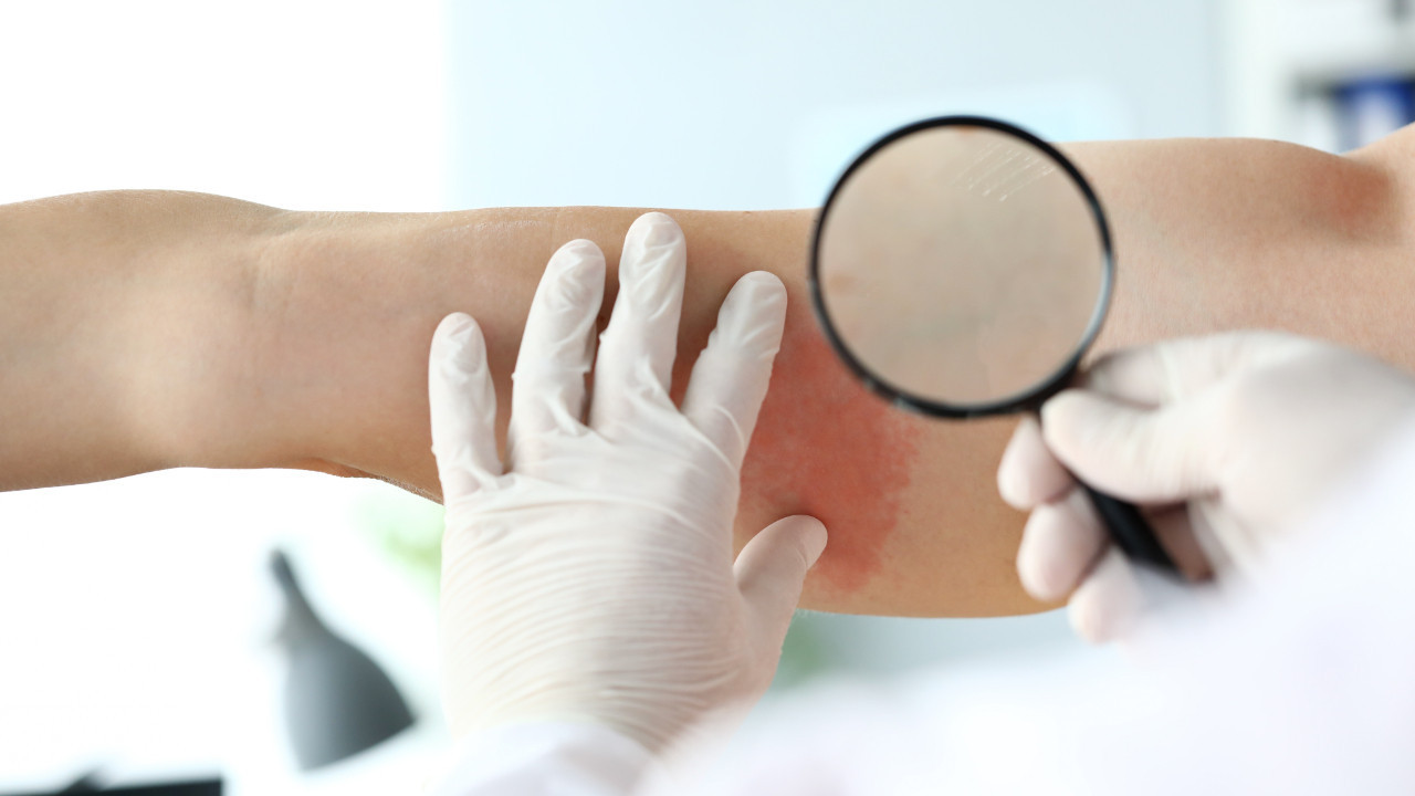 ciltte gorulen basit bir dokuntu bize cok sey anlatiyor olabilir XGNePp2Y.jpg