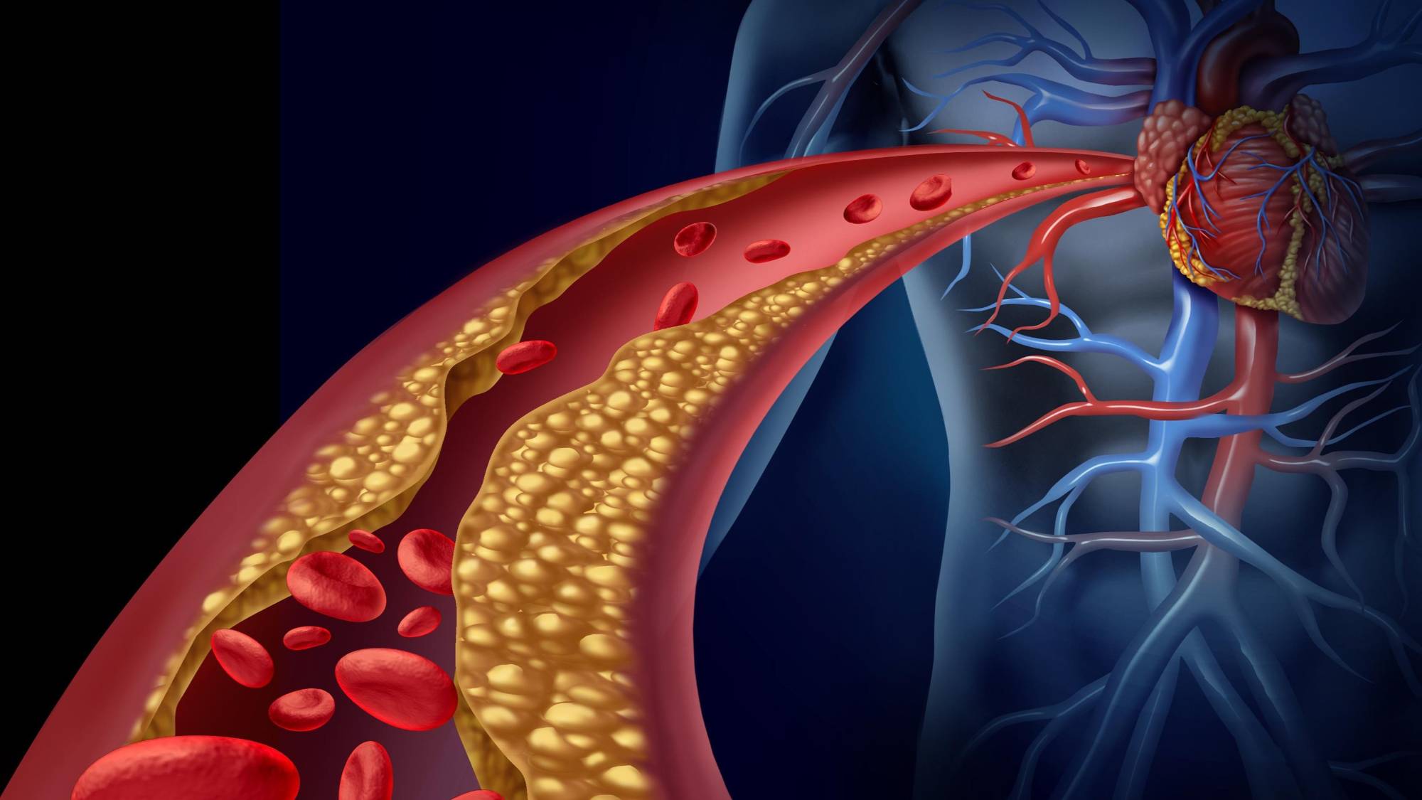 Prof. Dr. Sönmez: Türkiye’de Ailesel Hiperkolesterolemi dünya ortalamasının iki katı