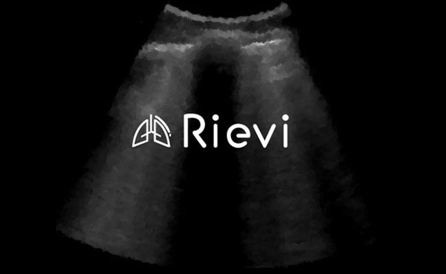 Akciğer Ultrasonunda Yapay Zeka Kullanımı